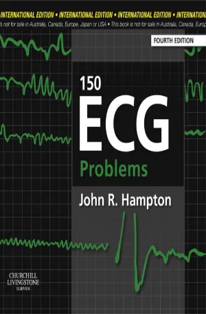 150 ECG Problems - John R. Hampton DM MA DPhil FRCP FFPM FESC www.zbooks.in